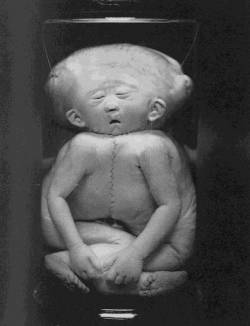 Kryptosexual Cancroid : Social Repression Becomes Social Aggression Kryptosexual Cancroid : Social Repression Becomes Social Aggression